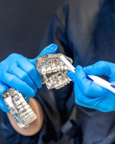 Ce materiale dentare pot combina rezistența mecanică și estetica?
