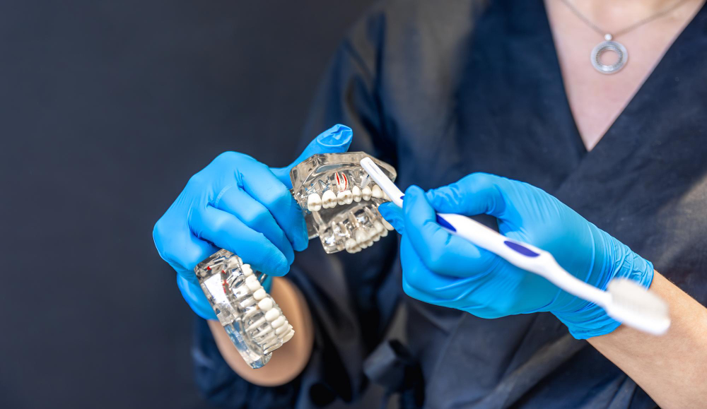 Ce materiale dentare pot combina rezistența mecanică și estetica?